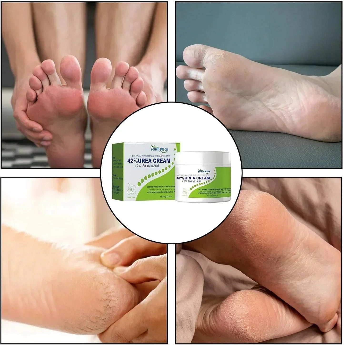 South Moon - 42% Urea Cream + 2% Salicylic Acid